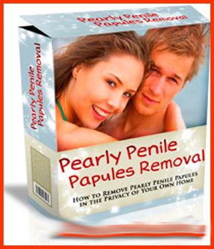 pearly penile papules removal ebook pdf free